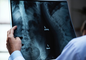 Ενδοσκοπική Αντιμετώπιση Κύστης Κόκκυγα (EPSIT)