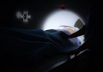 Τι είναι η ακτινοθεραπεία