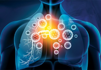 Λοιμώξεις του αναπνευστικού και πώς αντιμετωπίζονται