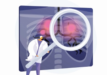 O ρόλος του ενδοβρογχικού υπερήχου (EBUS) στην αντιμετώπιση του καρκίνου του πνεύμονα