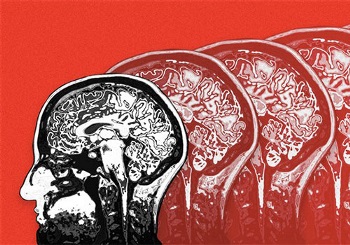 ΙΟΥΝΙΟΣ: Ο μήνας ευαισθητοποίησης για τη νόσο του Alzheimer