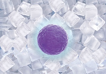 Διατήρηση γονιμότητας: H κατάψυξη ωαρίων δίνει τη λύση!