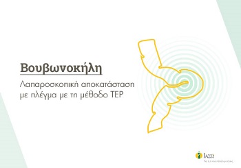 Βουβωνοκήλη – Λαπαροσκοπική αποκατάσταση με πλέγμα