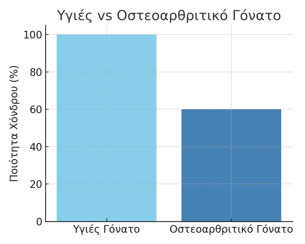 osteo1 Οστεοαρθρίτιδα Γόνατος – Τι Πρέπει να Ξέρετε: Πόνος, Αντιμετώπιση και Πρόληψη