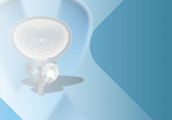 Καρκίνος του προστάτη