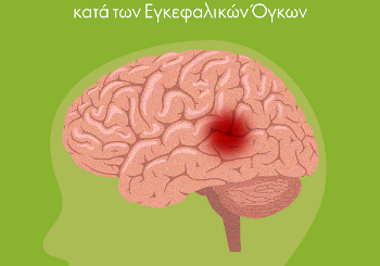 Όγκοι Εγκεφάλου – Όσα χρειάζεται να γνωρίζετε