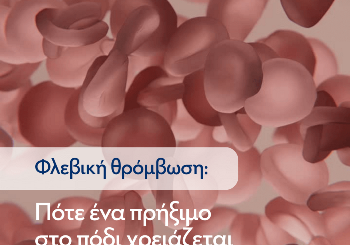 Φλεβική θρόμβωση: Πότε ένα πρήξιμο στο πόδι χρειάζεται προσοχή;