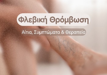 Φλεβική θρόμβωση - Αίτια, συμπτώματα & θεραπεία Φλεβική θρόμβωση - Αίτια, συμπτώματα & θεραπεία