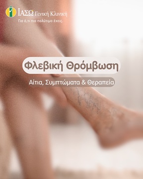 πόδι με φλεβική θρόμβωση πόδι με φλεβική θρόμβωση