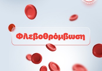 Φλεβοθρόμβωση