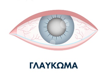 Τι είναι το γλαύκωμα; Υπάρχει πρόληψη;