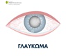 Τι είναι το γλαύκωμα; Υπάρχει πρόληψη;