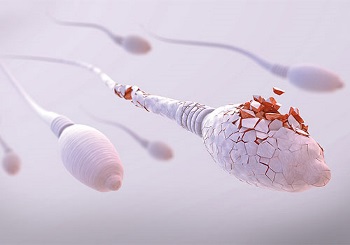 H υπογονιμότητα του άνδρα