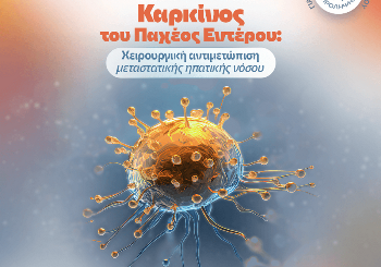 Μήνας Πρόληψης Και Ενημέρωσης Για Τον Καρκίνο Του Παχέος Εντέρου- Χειρουργική αντιμετώπιση μεταστατικής ηπατικής νόσου