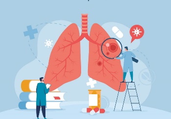 Ιδιοπαθής Πνευμονική Ίνωση