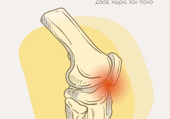 Οστεοαρθρίτιδα Γόνατος: Συμπτώματα, Αντιμετώπιση και Πρακτικές Συμβουλές για Καλύτερη Ζωή