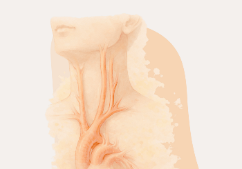 Η καρωτιδική νόσος, ένας «σιωπηλός κίνδυνος».