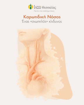 Η καρωτιδική νόσος, ένας «σιωπηλός κίνδυνος».