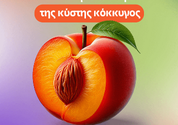 Η αντιμετώπιση της κύστης κόκκυγος - Τα συμπτώματα και η θεραπεία του τριχοφωλεακού συριγγίου στην παιδική ηλικία