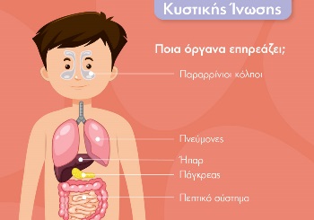 Τι είναι η Κυστική Ίνωση – Συμπτώματα και Διάγνωση