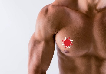 Ανδρικός καρκίνος του μαστού: Ένας χρήσιμος οδηγός