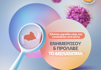 Μελάνωμα: Ενημερώσου για να προστατευτείς