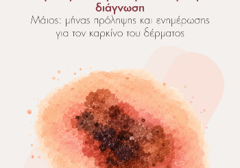 Μελάνωμα & Καρκίνος Δέρματος: Συμπτώματα, Πρόληψη και Έγκαιρη Διάγνωση