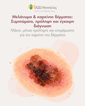 Συμβολική απεικόνιση μελανώματος