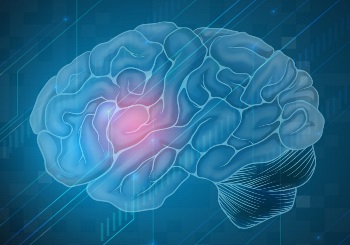 Αγγειακά Εγκεφαλικά Επεισόδια – Υπάρχει θεραπεία στην οξεία φάση