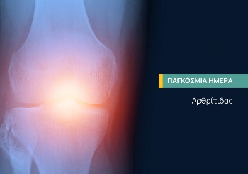 Παγκόσμια Ημέρα Αρθρίτιδας Παγκόσμια Ημέρα Αρθρίτιδας