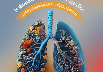 Παγκόσμια ημέρα κατά της Φυματίωσης: Μπορούμε να την εξαλείψουμε