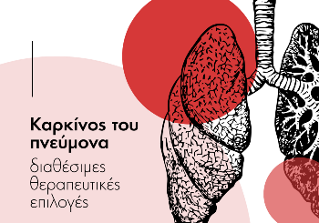 Καρκίνος του Πνεύμονα – Τα στάδια και η θεραπεία Καρκίνος του Πνεύμονα – Τα στάδια και η θεραπεία