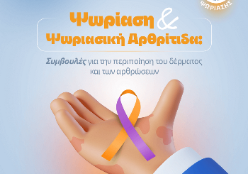 Ψωρίαση και Ψωριασική Αρθρίτιδα: Συμβουλές για την περιποίηση του δέρματος και των αρθρώσεων