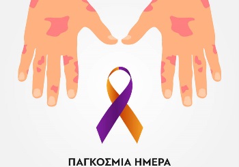 Τι είναι η ψωριασική αρθρίτιδα