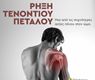 Ρήξη τενοντίου πετάλου: Μια από τις συχνότερες αιτίες πόνου στον ώμο