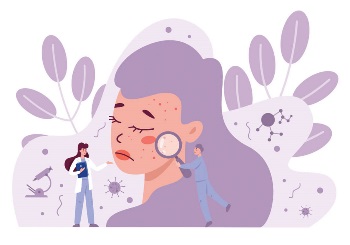 Ροδόχρους Νόσος: Συμπτώματα και Θεραπεία