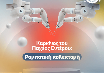 Ρομποτική Κολεκτομή