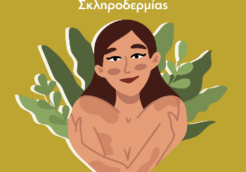 Σκληρόδερμα: Όσα πρέπει να γνωρίζετε