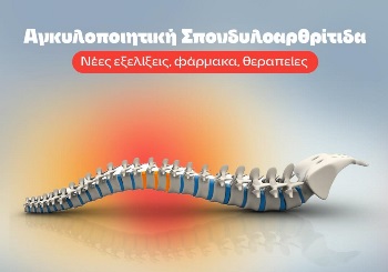 Αγκυλοποιητική σπονδυλοαρθρίτιδα - Νέες εξελίξεις, φάρμακα, θεραπείες Αγκυλοποιητική σπονδυλοαρθρίτιδα - Νέες εξελίξεις, φάρμακα, θεραπείες