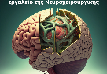 Στεροτακτική βιοψία όγκου εγκεφάλου, το σύγχρονο εργαλείο της Νευροχειρουργικής