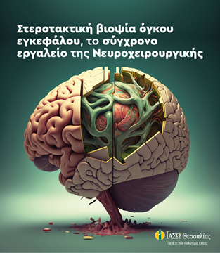 Στεροτακτική βιοψία όγκου στον εγκέφαλο