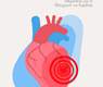 Μυοκαρδίτιδα: Συμπτώματα, Αιτίες και Θεραπεία για τη Φλεγμονή της Καρδιάς
