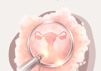 Υστεροσκόπηση: Τι Είναι και Πότε Χρειάζεται;