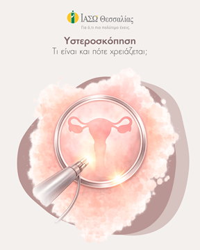 Υστεροσκόπηση: Τι Είναι και Πότε Χρειάζεται;