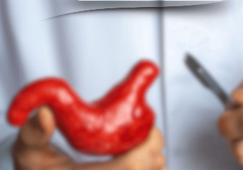 Βαριατρική Χειρουργική: Τι αλλάζει στη ζωή μετά το χειρουργείο