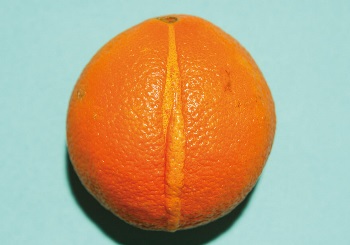 Femilift: Ενισχύοντας την ποιότητα ζωής των γυναικών