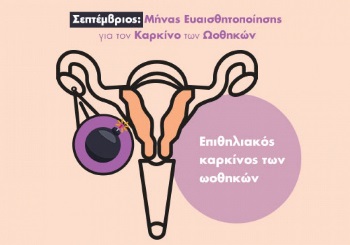 Επιθηλιακός καρκίνος των ωοθηκών