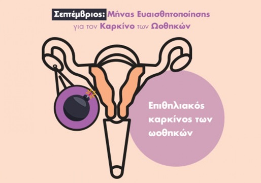 Επιθηλιακός καρκίνος των ωοθηκών Επιθηλιακός καρκίνος των ωοθηκών
