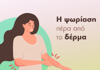 Η Ψωρίαση πέρα από το δέρμα