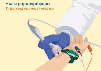 Ηλεκτρομυογράφημα, τι δείχνει και γιατί γίνεται